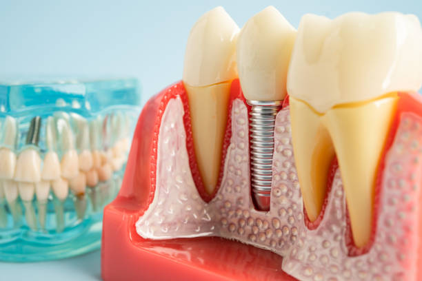 Best Dental Exams and Cleanings  in Citrus Heights, CA